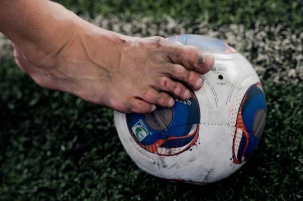 FIFA将试验防诈伤新规：球员恢复后等2分钟才能重新进场